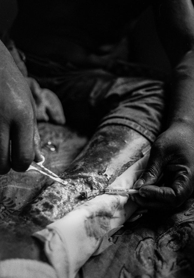 A Chicago heroin addict removes a chunk of rotten flesh from an abscess while discussing the existence of God and the problem of evil.